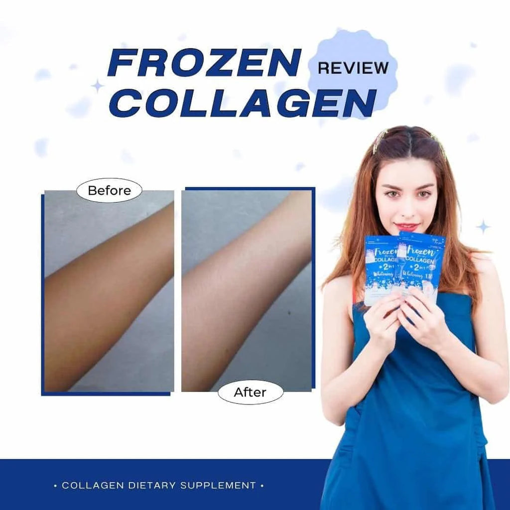 Frozen Collagen